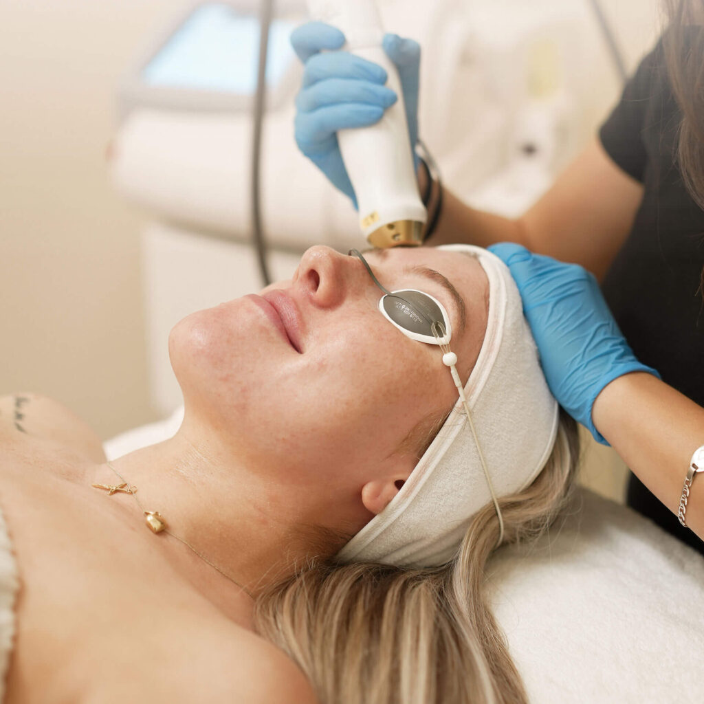 fractional skin resurfacing treatment in Vancouver BC