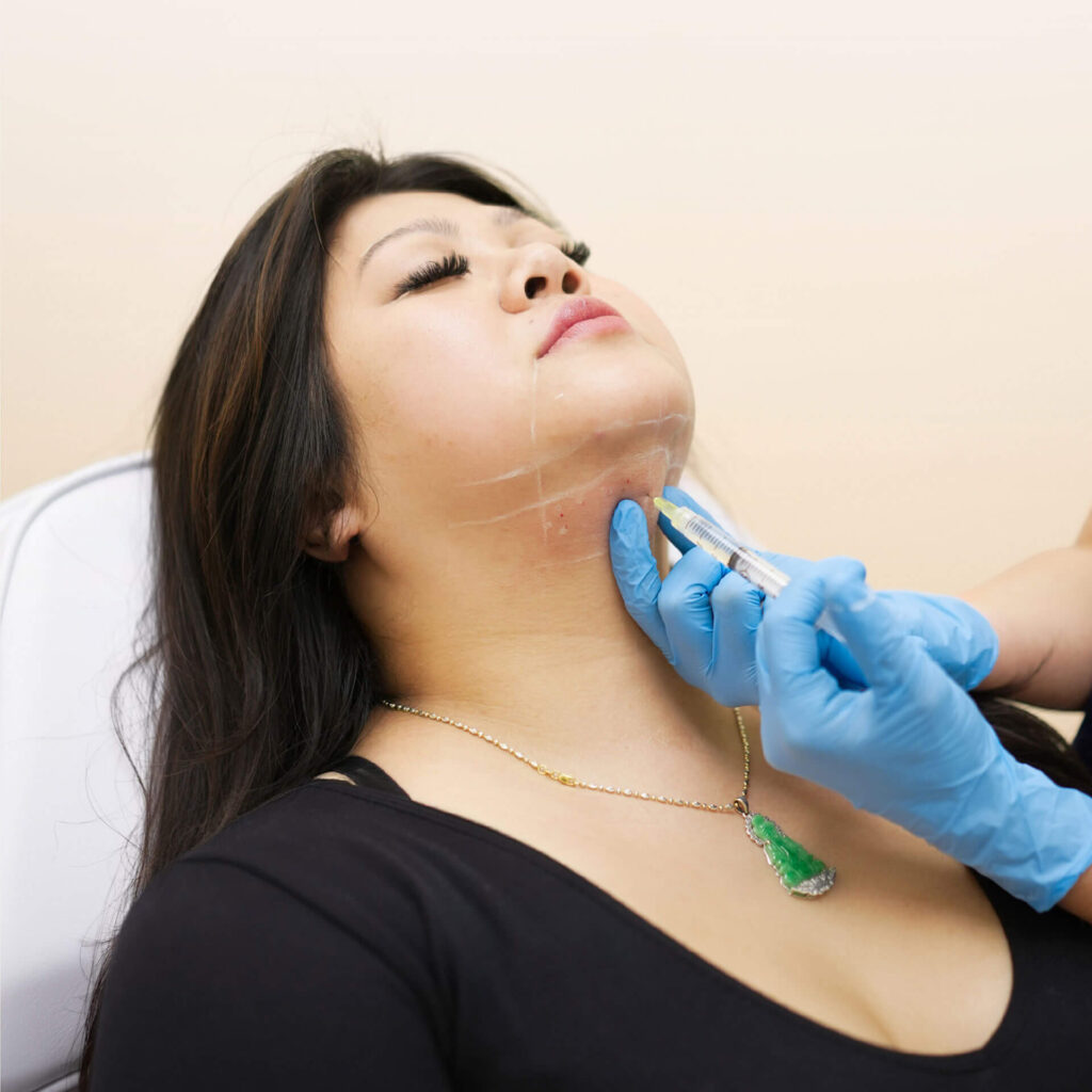 Double chin reduction treatment Vancouver BC