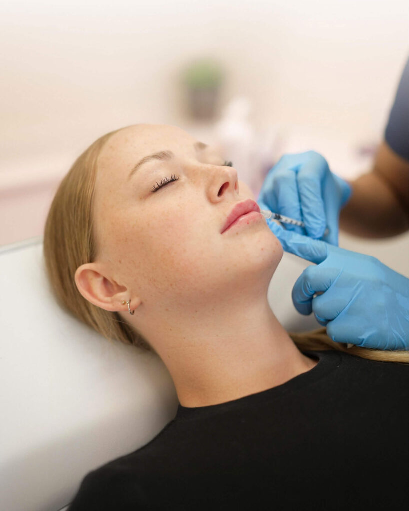 Dermal fillers treatment in Vancouver BC