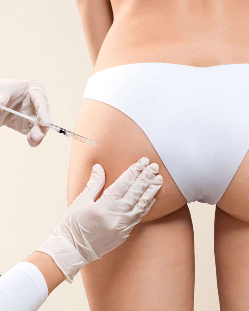 Scupltra buttocks enhancement Vancouver BC