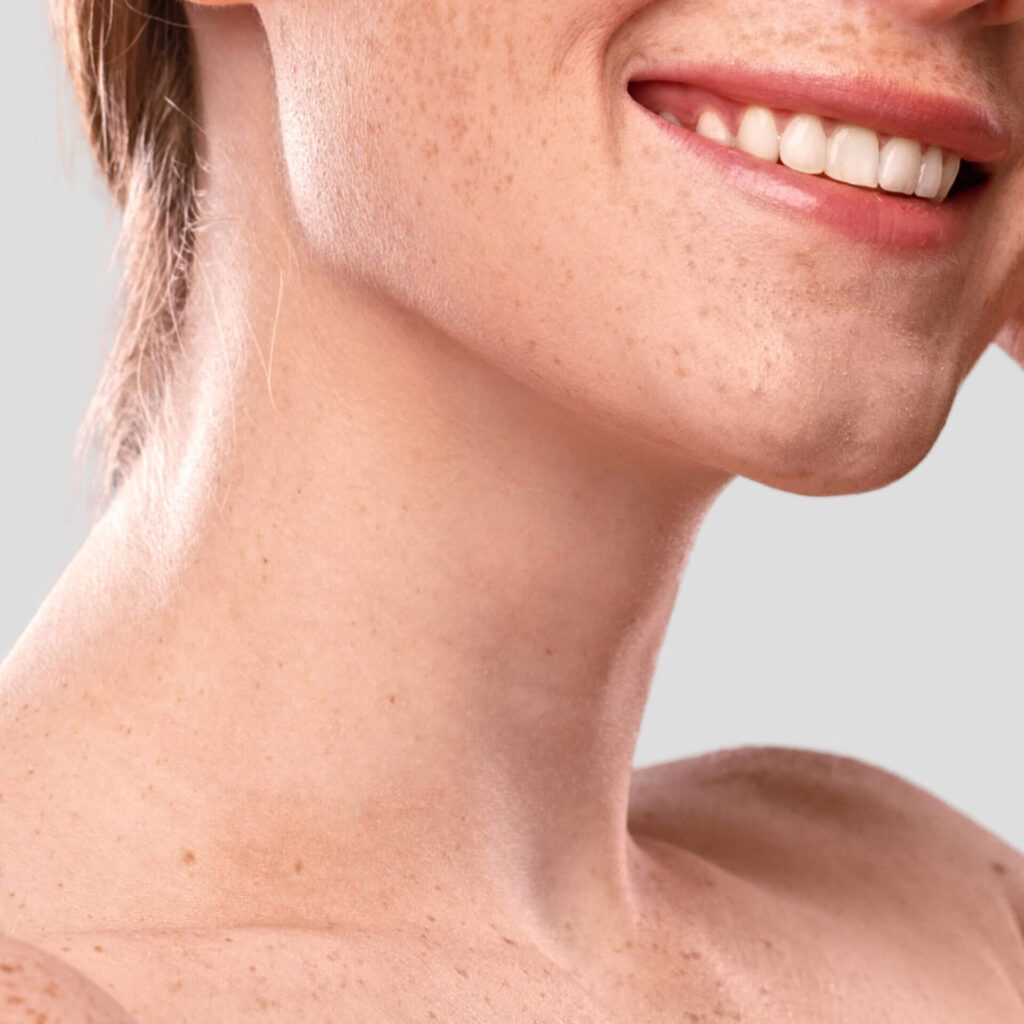 pigmentation spots removal Vancouver BC