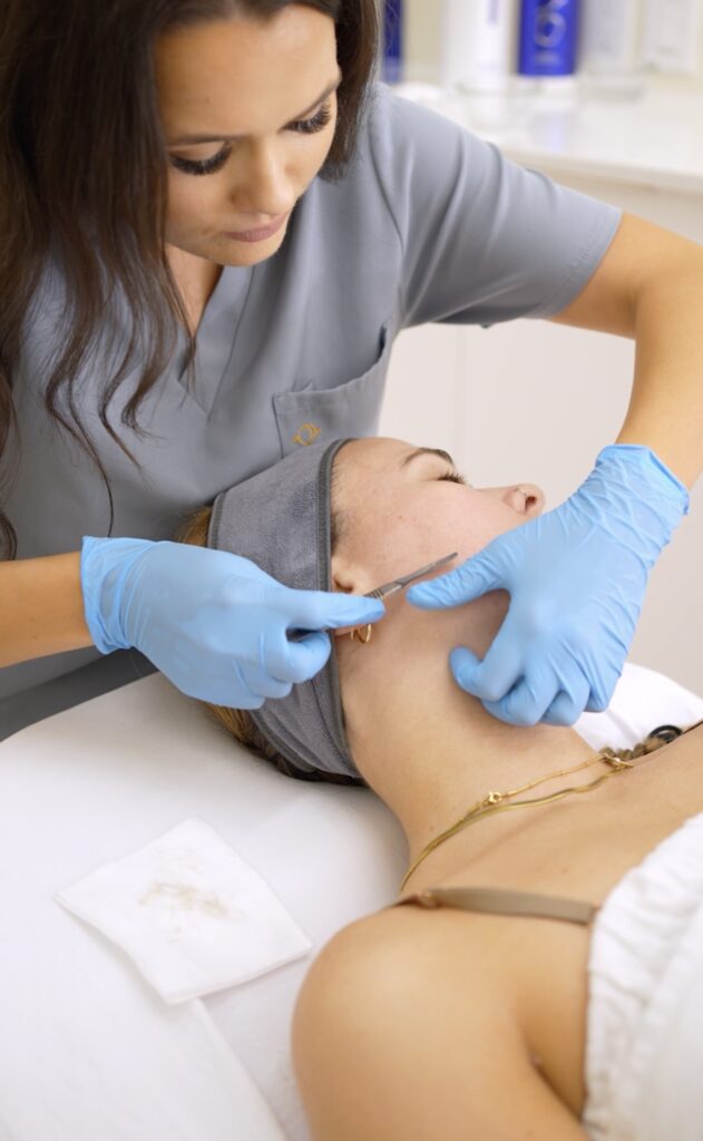 Dermaplaning
